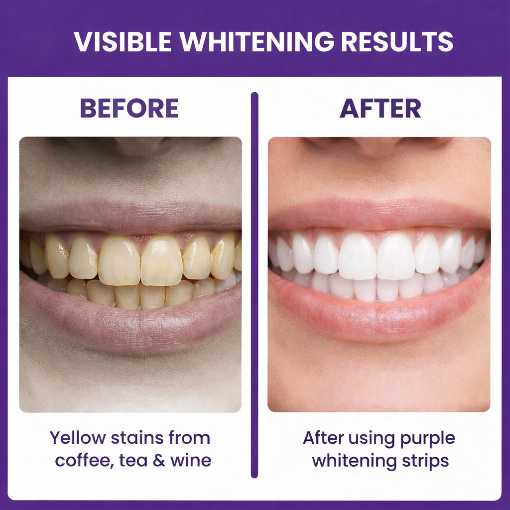 DrDent Teeth Whitening Strips